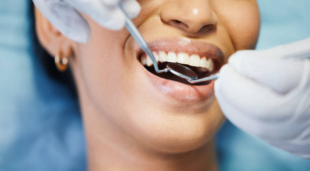 Best Emergency Cosmetic Dentistry (e.g., broken veneers) in Streator, IL